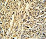 IMPDH2 Antibody in Immunohistochemistry (IHC)