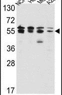 IMPDH2 Antibody in Western Blot (WB)