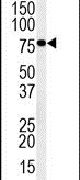 INO80D Antibody in Western Blot (WB)