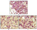 INHA Antibody in Immunohistochemistry (Paraffin) (IHC (P))