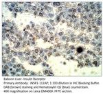 Insulin Receptor Antibody in Immunohistochemistry (IHC)