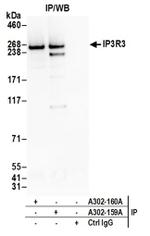 IP3R3 Antibody in Immunoprecipitation (IP)