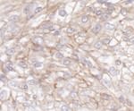 IQGAP1 Antibody in Immunohistochemistry (IHC)