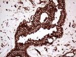 IQGAP1 Antibody in Immunohistochemistry (Paraffin) (IHC (P))