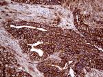 IQGAP1 Antibody in Immunohistochemistry (Paraffin) (IHC (P))