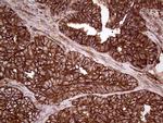 IQGAP1 Antibody in Immunohistochemistry (Paraffin) (IHC (P))