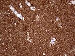 IQGAP1 Antibody in Immunohistochemistry (Paraffin) (IHC (P))