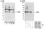 IRF2 Antibody in Western Blot (WB)