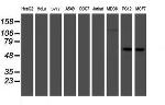 IRF6 Antibody in Western Blot (WB)