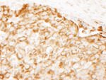 IRS1 Antibody in Immunohistochemistry (IHC)