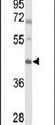 IRX2 Antibody in Western Blot (WB)