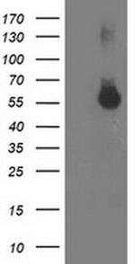 ITFG2 Antibody in Western Blot (WB)