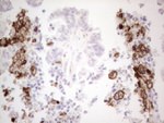 ITGAM Antibody in Immunohistochemistry (Paraffin) (IHC (P))