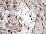 ITGAM Antibody in Immunohistochemistry (Paraffin) (IHC (P))