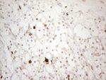 ITGAM Antibody in Immunohistochemistry (Paraffin) (IHC (P))