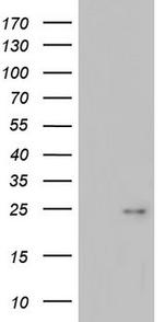 ITGB1BP1 Antibody in Western Blot (WB)