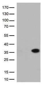 ITGB1BP3 Antibody in Western Blot (WB)