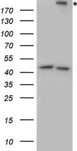 ITGB4 Antibody in Western Blot (WB)