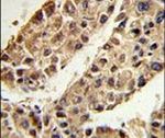 ITIH2 Antibody in Immunohistochemistry (IHC)