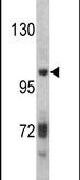 ITIH2 Antibody in Western Blot (WB)