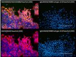 Mouse IgG1 Isotype Control in Immunocytochemistry (ICC/IF)