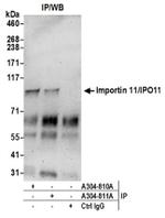 Importin 11/IPO11 Antibody in Immunoprecipitation (IP)