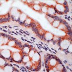 ITGB5 Antibody in Immunohistochemistry (IHC)