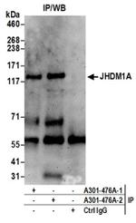 JHDM1A Antibody in Western Blot (WB)