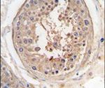 JLP Antibody in Immunohistochemistry (IHC)