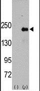 JLP Antibody in Western Blot (WB)