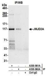 JMJD2A Antibody in Western Blot (WB)