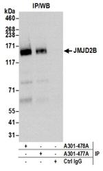 JMJD2B Antibody in Immunoprecipitation (IP)