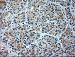 JNK1 Antibody in Immunohistochemistry (Paraffin) (IHC (P))