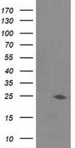 JOSD1 Antibody in Western Blot (WB)