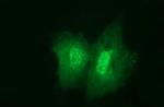 JPH2 Antibody in Immunocytochemistry (ICC/IF)