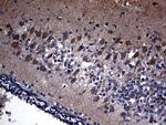 KAL1 Antibody in Immunohistochemistry (Paraffin) (IHC (P))