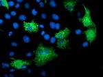 KATNB1 Antibody in Immunocytochemistry (ICC/IF)