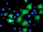 KATNB1 Antibody in Immunocytochemistry (ICC/IF)