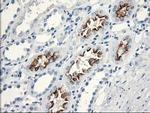 KATNB1 Antibody in Immunohistochemistry (Paraffin) (IHC (P))