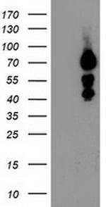 KATNB1 Antibody in Western Blot (WB)