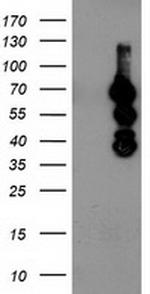 KATNB1 Antibody in Western Blot (WB)