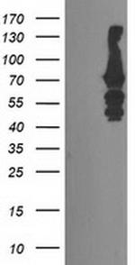 KATNB1 Antibody in Western Blot (WB)