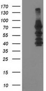KATNB1 Antibody in Western Blot (WB)