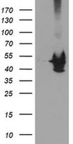 KCNAB1 Antibody in Western Blot (WB)