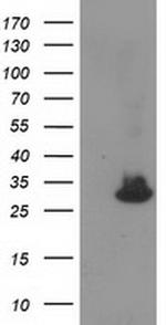 KCTD14 Antibody in Western Blot (WB)