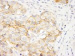 KIAA0528 Antibody in Immunohistochemistry (IHC)