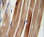 KIAA1310 Antibody in Immunohistochemistry (IHC)