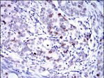 KID Antibody in Immunohistochemistry (Paraffin) (IHC (P))