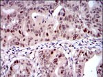 KID Antibody in Immunohistochemistry (Paraffin) (IHC (P))