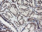 KIF25 Antibody in Immunohistochemistry (Paraffin) (IHC (P))